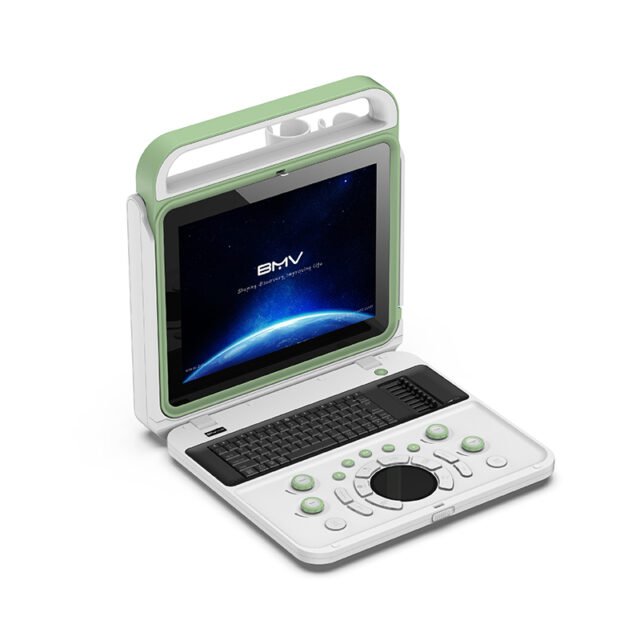 BPU50C Portable Color Doppler Ultrasound(Color Doppler System Improve Patient Care Quality)