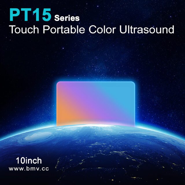 PulseTouch™PT15 EXP 10inch Touch Color Doppler Point-of-Care Imaging Ultrasound System