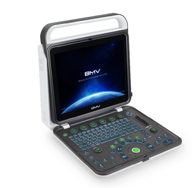 BPU60C Advanced Color Doppler Ultrasound Scanner System(64 Channels/Providing Comprehensive and Efficient Diagnoses)